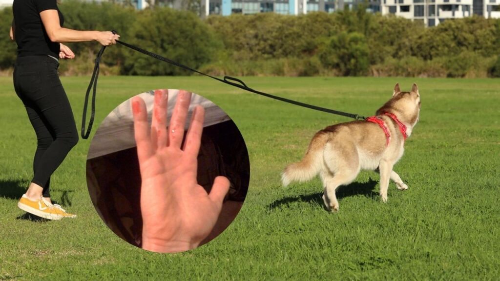 What to Put on Rope Burn from Dog Leash (My First-Aid Experience)