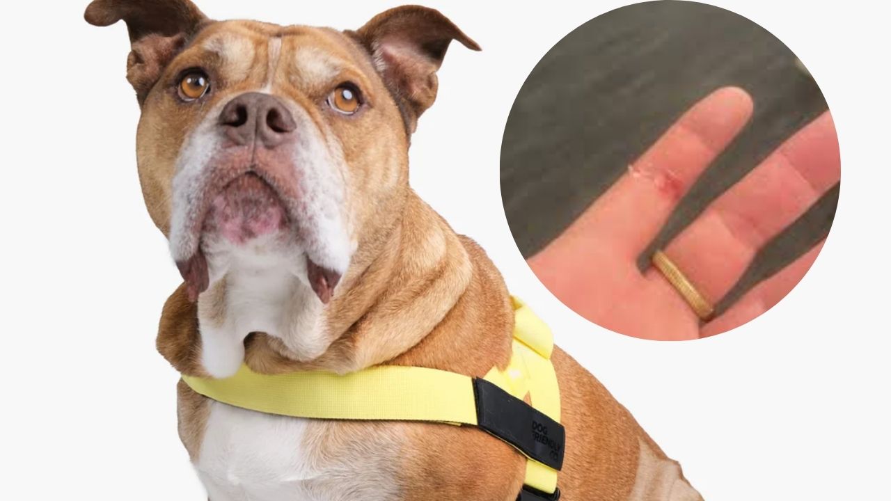 What to Put on a Rope Burn from a Dog Leash in 2025?